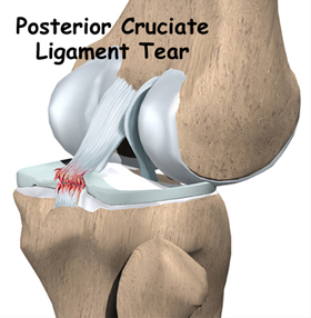 PCL-Reconstruction